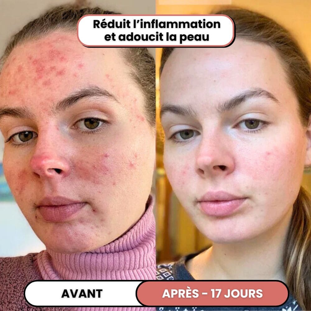 Lusvela | Soin Haute Fréquence 2.0®