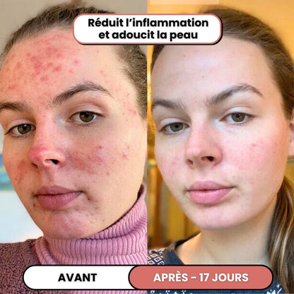 Lusvela | Soin Haute Fréquence 2.0®