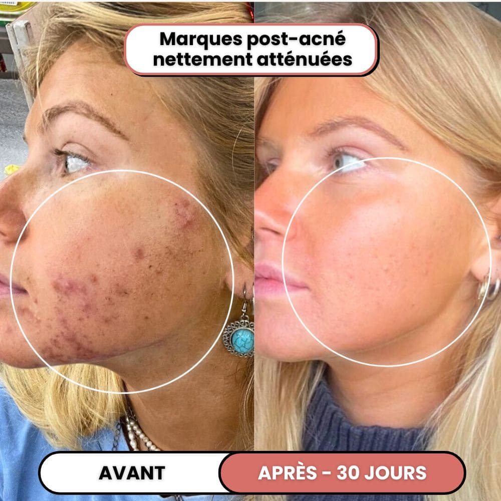 Lusvela | Soin Haute Fréquence 2.0®