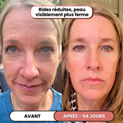 Lusvela | Soin Haute Fréquence 2.0®