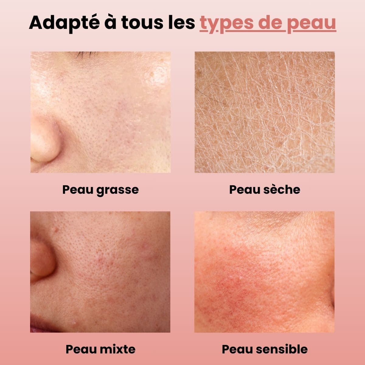 Lusvela | Soin Haute Fréquence 2.0®