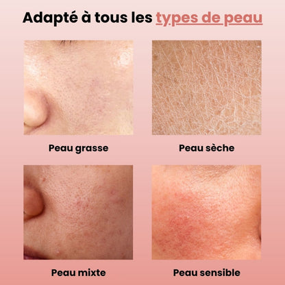 Lusvela | Soin Haute Fréquence 2.0®